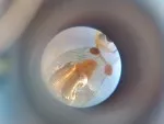 Krmivo-koretra pod mikroskopem