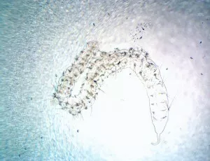 Detritus worm, jakási hlístice